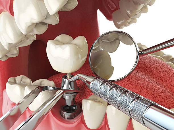 Fast & Reliable Emergency Dental Services in IA